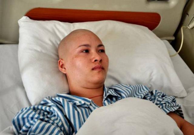 肝癌晚期病人图片图片