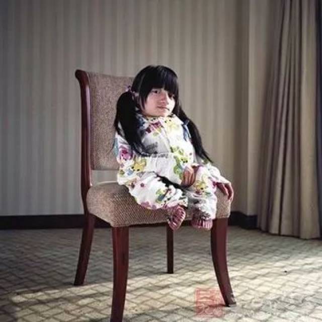 【罕见病】121种罕见病解读(3)