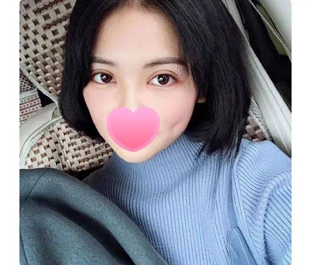 案例| 内双眼皮妹纸,30天逆袭气质美女!这变化堪称脱胎换骨了.