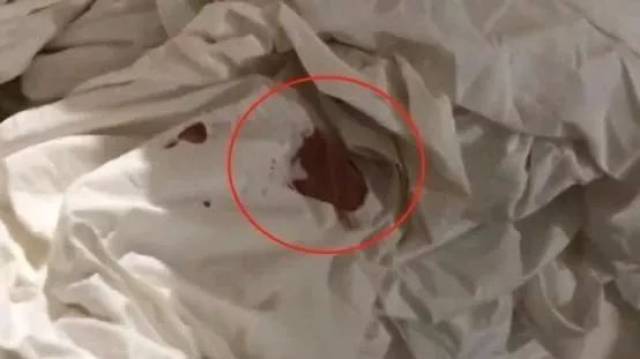 带血床单,脏毛巾加工业草酸"混合洗",快捷酒店你还敢睡吗?
