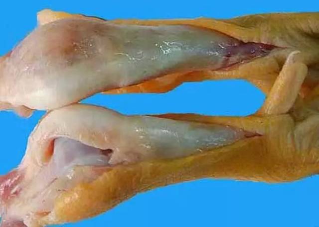 腓肠肌腱脱出原位,腿变弯曲或扭曲,不能站立和行走,跗关节明显肿大,两