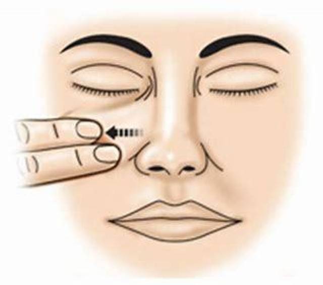 鼻子窒息感,可能与鼻瓣区狭窄,鼻阀功能不良有关 (原创)_手机搜狐网