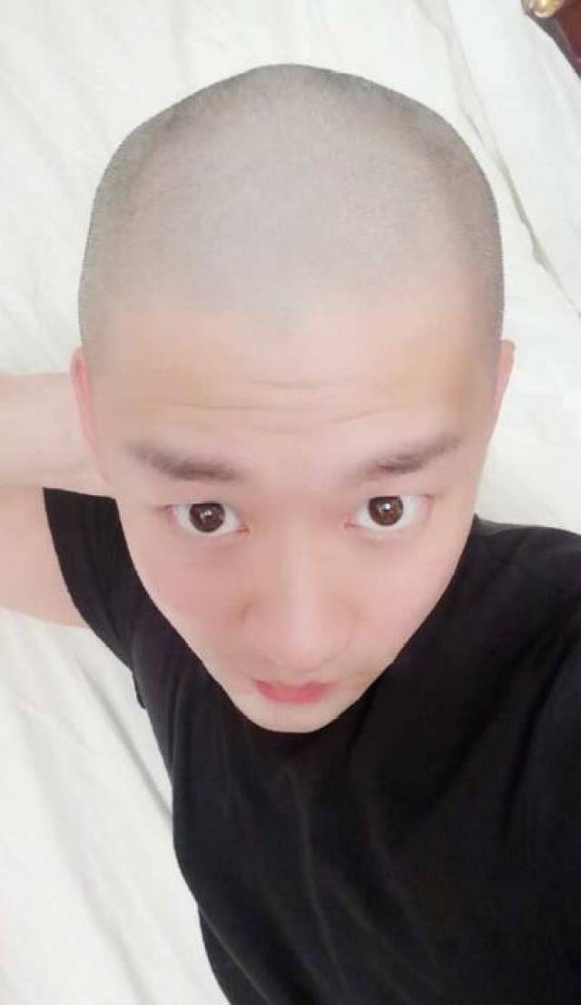 曹云金自曝抑郁症后剃光头发,专家教你如何缓解抑郁症!