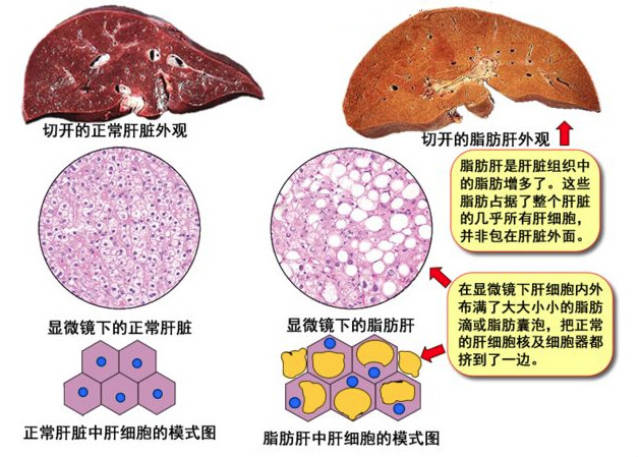 正常肝脏病理切片图解图片