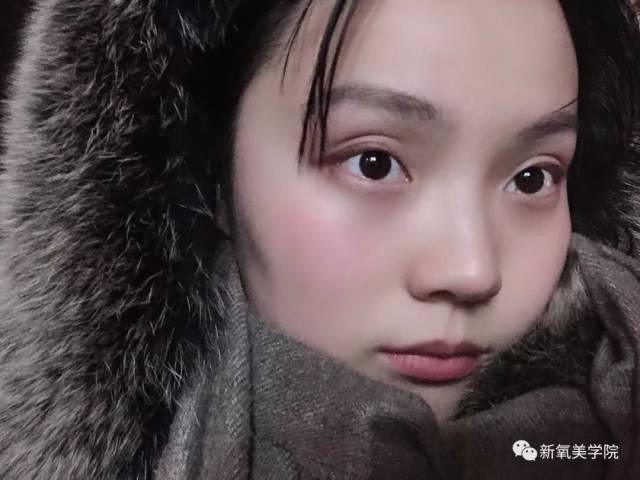 不过韩韩的眼睛 有轻微的上睑下垂症状,换句话说, 上眼睑有些许遮瞳的