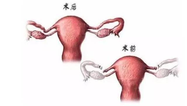 属整形手术. 最早的输卵管复通术在肉眼下进行,成功率较低.