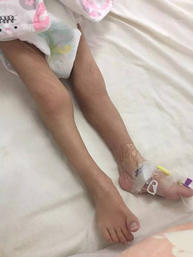 据主治医生介绍:经过对女婴的初步检查,女婴很可能是一名脑瘫儿童