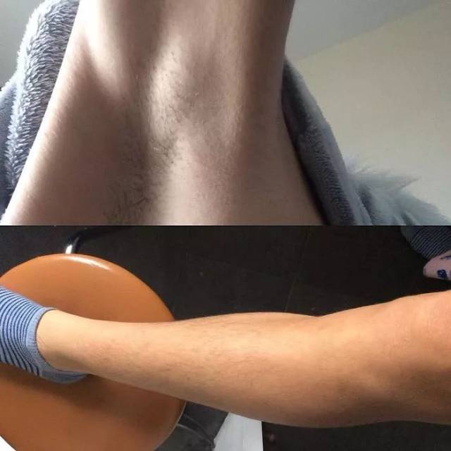 她们在网上掀起"不剃毛"活动,引来无数网友秀腋毛.