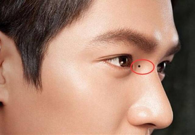 这五处长痣的男人,最容易让妻儿受穷,不宜嫁