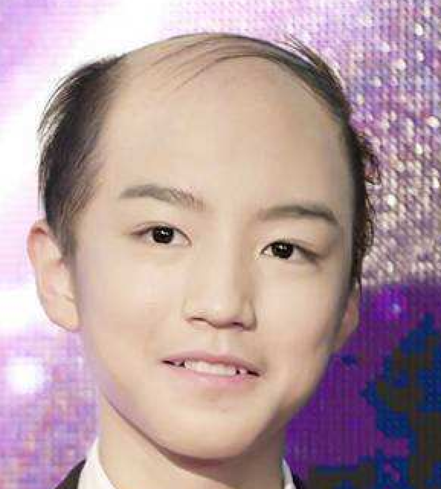 猝死不是当代青少年担心的问题, 脱发才是!