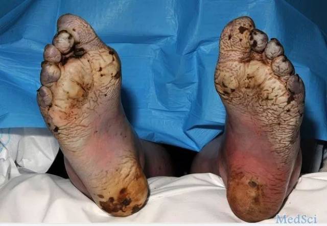 如果来年我变得冷漠,都怪这个冬天冻掉了我耳朵