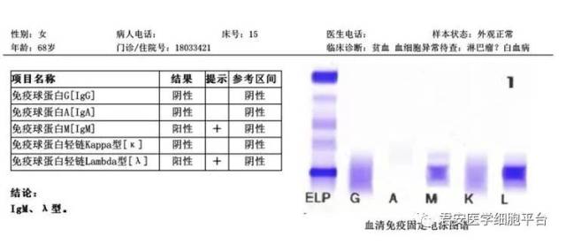 骨髓涂片报告图片