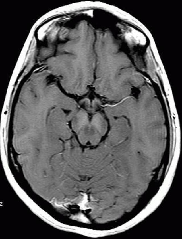 图文详解丨怎样区分不同序列的磁共振图像?