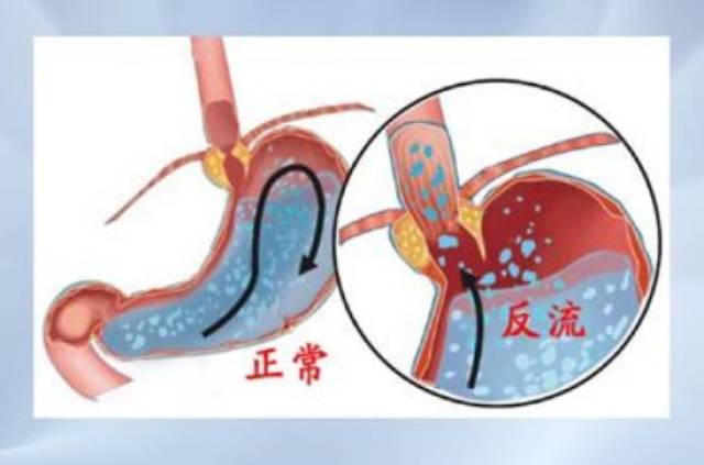 肠镜检查：揭开肠道健康的神秘面纱