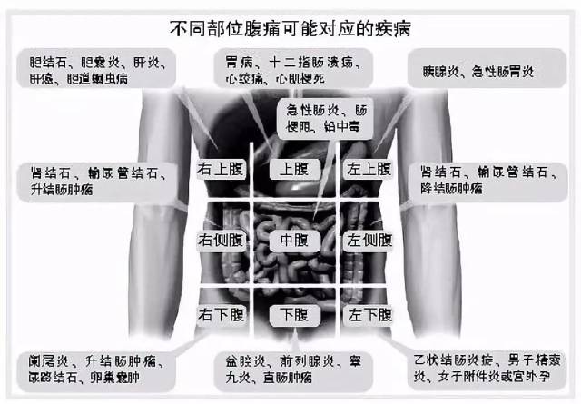 男性腹部疼痛位置图图片
