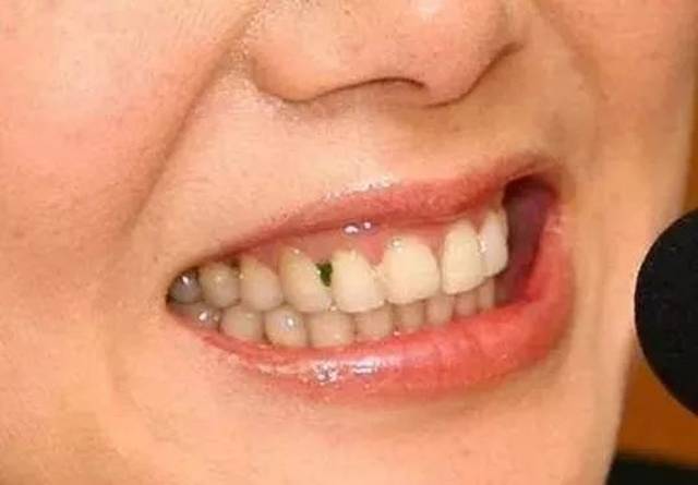 竟然是因为这个!