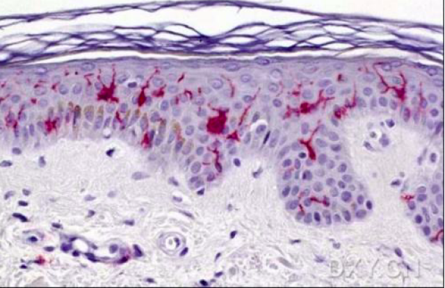 朗格汉斯细胞 (langerhans cell) 是皮肤内的一种功能最强的免疫活性