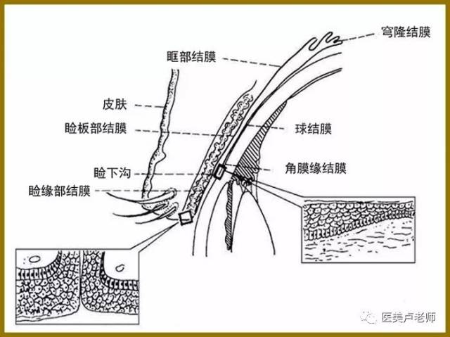 巩膜沟图片