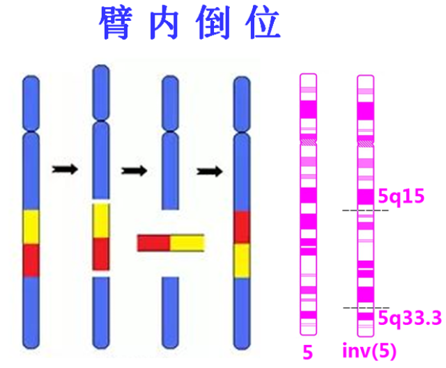 在配子形成中,染色体发生交换后,臂间倒位可导致染色体重组,倒位片段