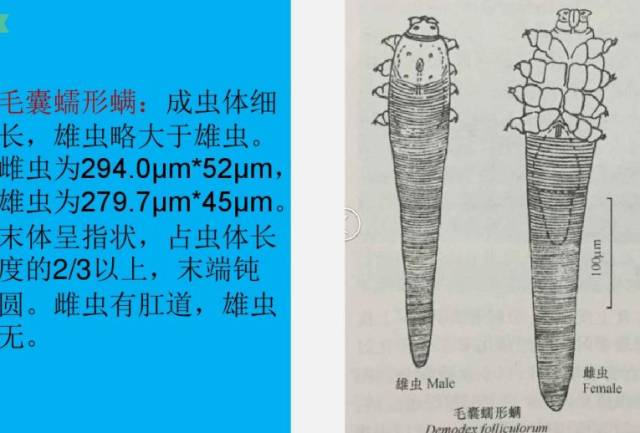 怎么去除脸上的毛囊虫?