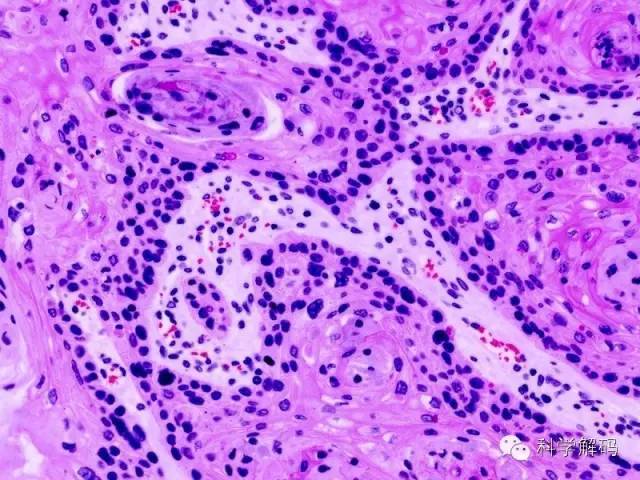 看清癌细胞的真面目!只需这11张图!