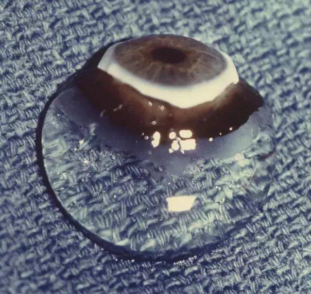 孩子说眼睛里有好多虫子,原因居然是