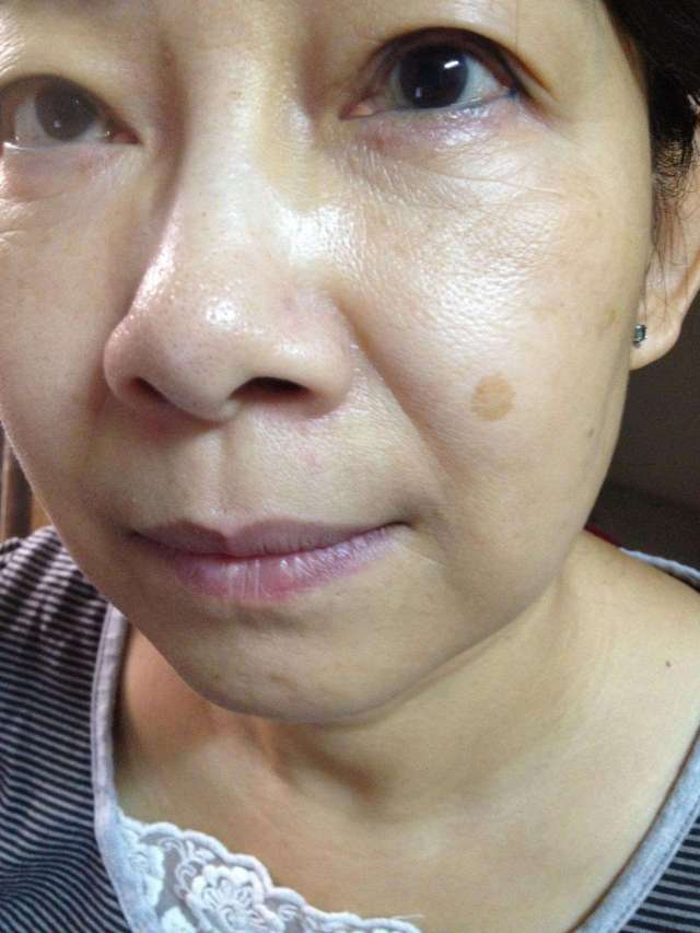 4种山里食物煮水喝美容养颜,是黄褐斑,肝斑的"死对头"