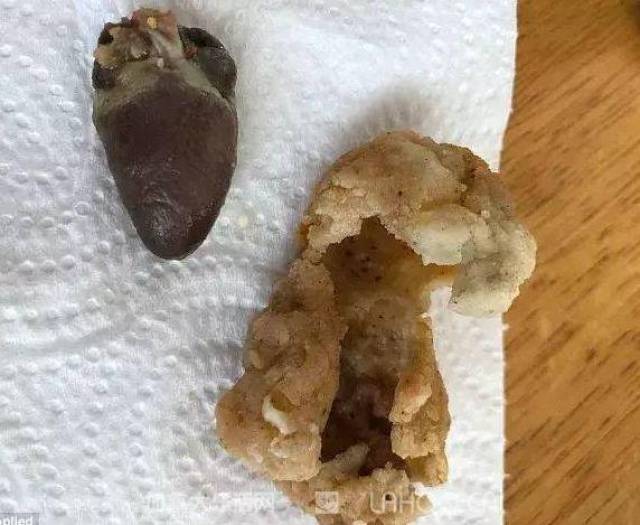 想吐炸鸡吃出蛆这些年我们曾吃到的神奇玩意儿