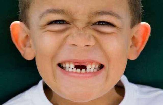小孩子满脸是牙的照片图片