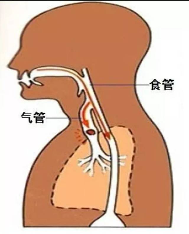 气管与食道的位置图图片