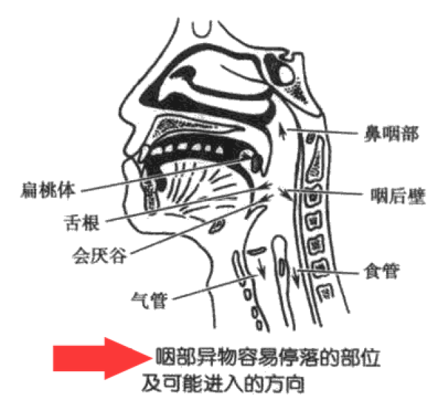 鱼刺卡喉,吞馒头?吃醋?都错错错!