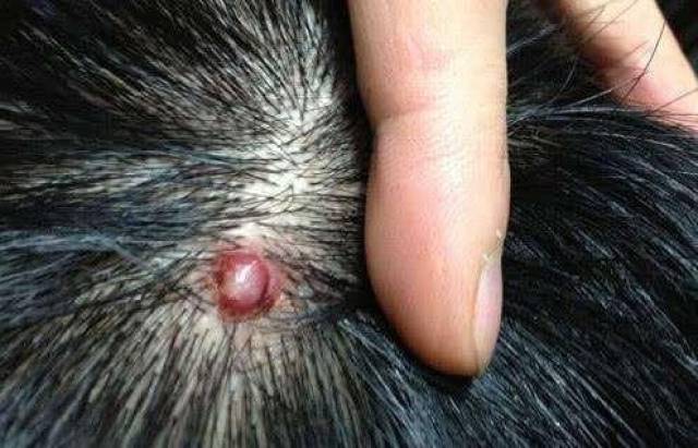 头上长脓包痘痘是身体在给我们通风报信2种植物给它治好