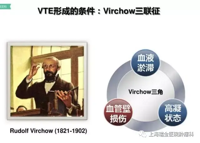 virchow三角图片