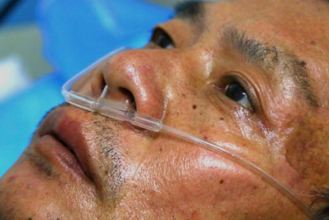 31岁销售员患肺癌,医生:若脸上出现1种"浮肿",可能肺已受损