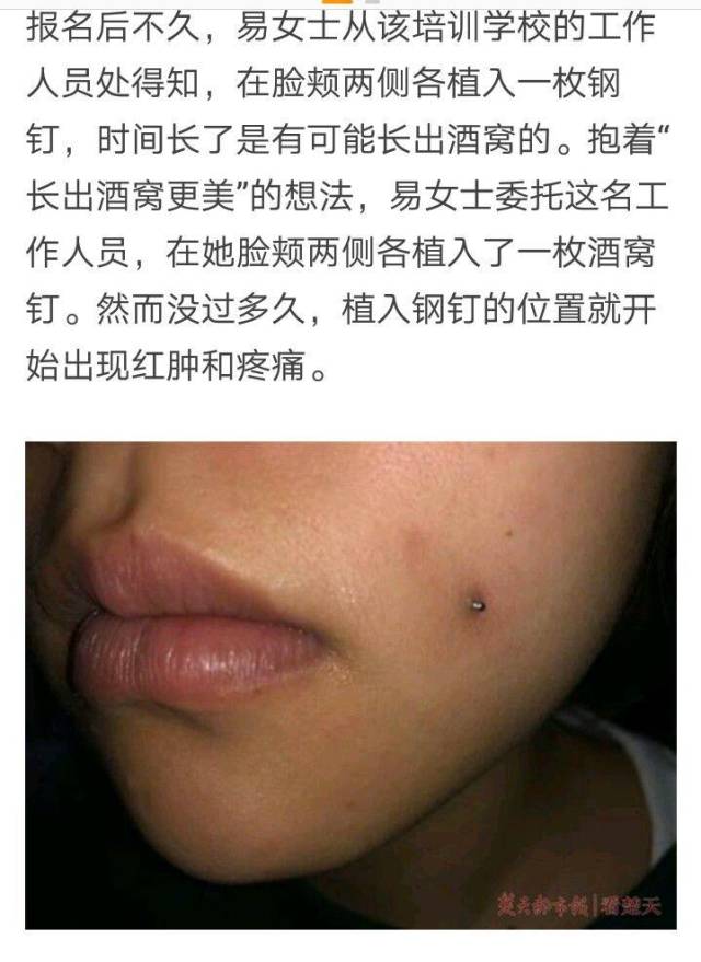 19岁女孩打钢钉种酒窝:你无知的样子真让人心疼