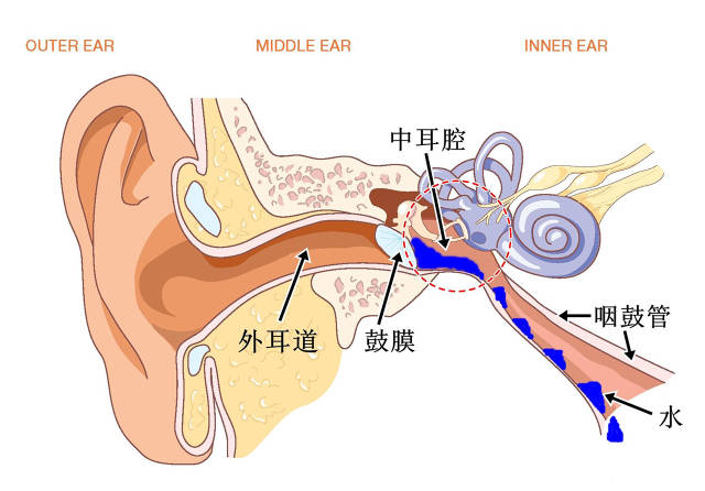 耳石症动画演示图片