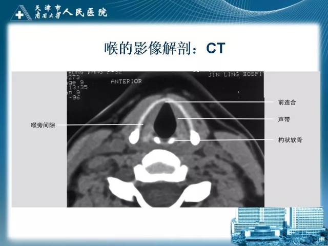 喉的应用解剖与影像解剖 