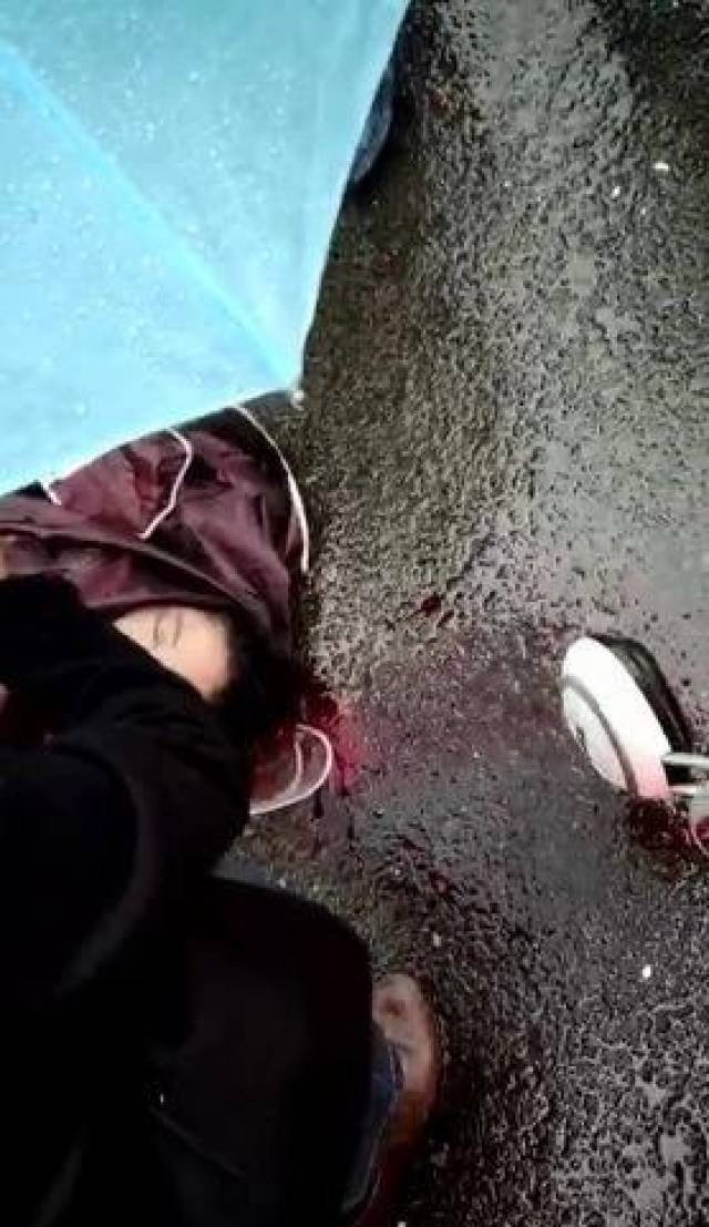 涟水郑梁梅学校旁女子摔的昏迷不醒,这位院长的举动很暖心!