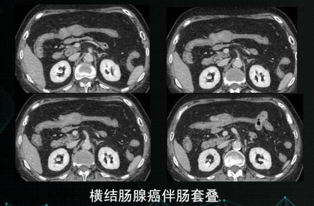 这种影像检查的比喻太形象了!