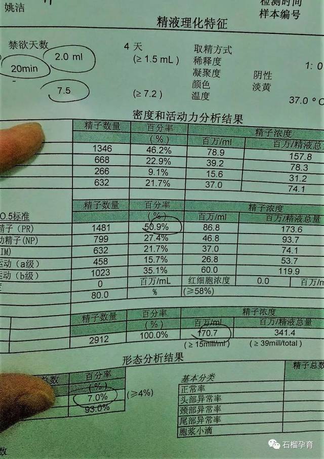 解密精子分离术生男生女 "玉女峰前第一声"-第2张图片-酷飞博客