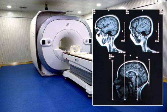 核磁共振成像技术在脑疾病检查中的作用