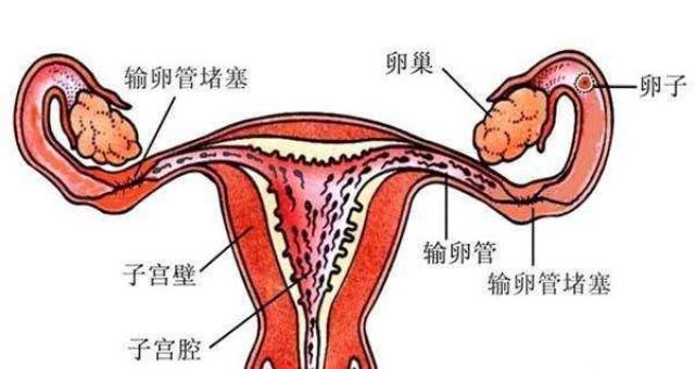 女性出现这种感觉可能是输卵管堵塞的信号最好及时去查下