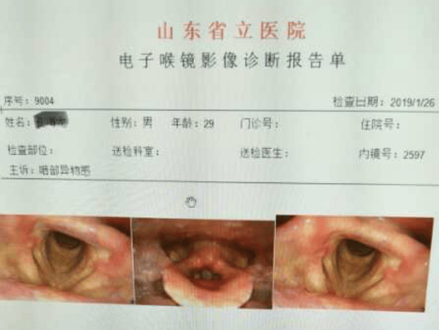 声带瘫痪,声带麻痹_大山谷图库