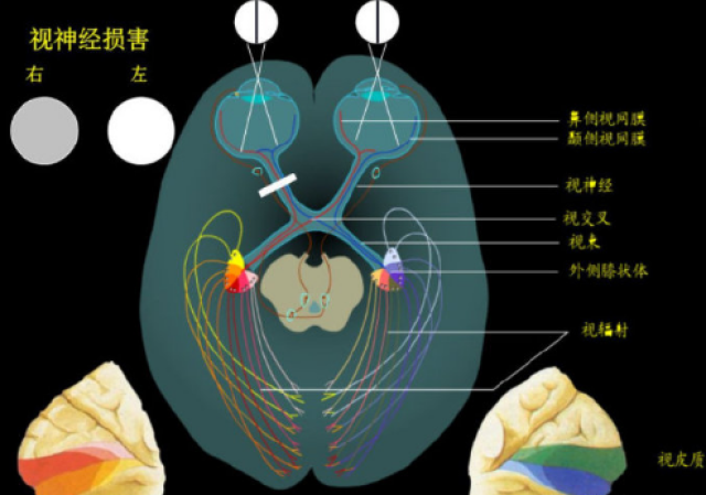 视神经管位于哪里图片
