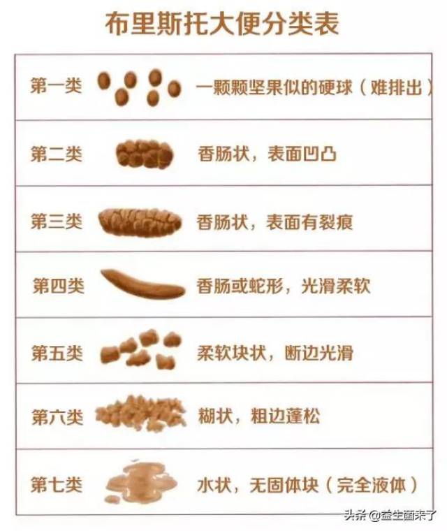 正常情况下,大便通常是香肠型,条型的软便,不粘便池1