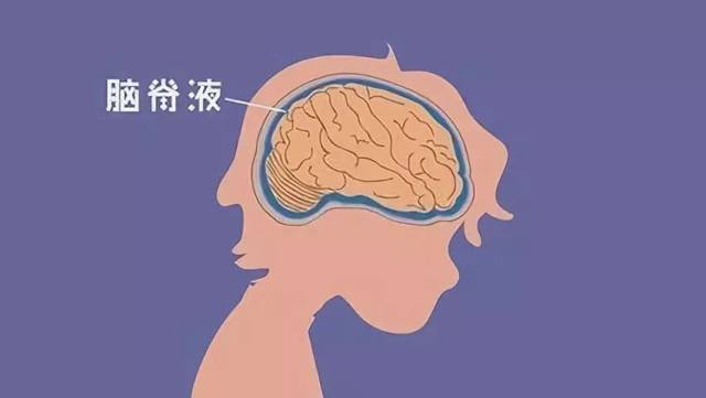 专家共识-神经外科脑脊液外引流的护理