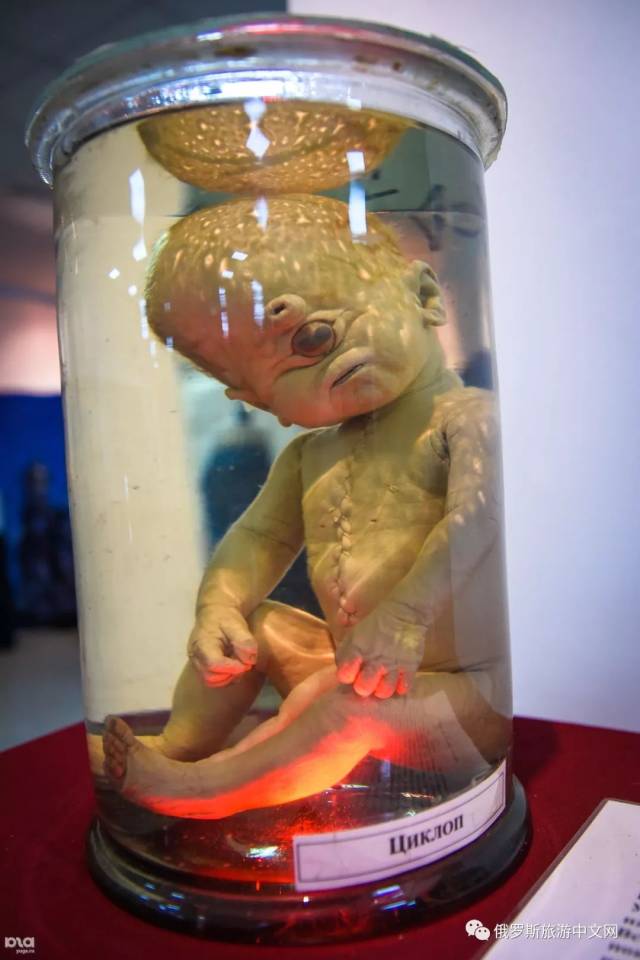 这些恐怖的畸形怪胎展,居然是俄罗斯圣彼得堡著名博物馆的镇馆之宝!