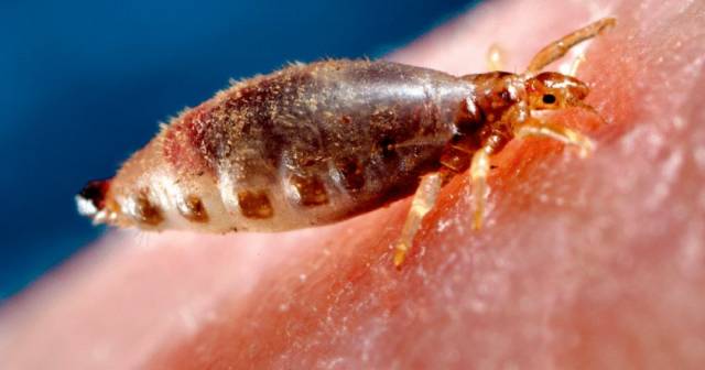 警惕,专家提醒加拿大居民一种超级虱子的突变链对治疗有抗药性!