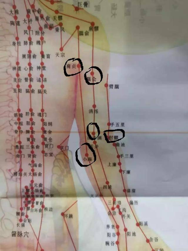 扳机点排尿图片