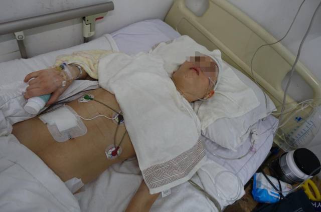 辗转多地求医令人泪目,重症脑积水患者终迎来第二次生命 (原创)